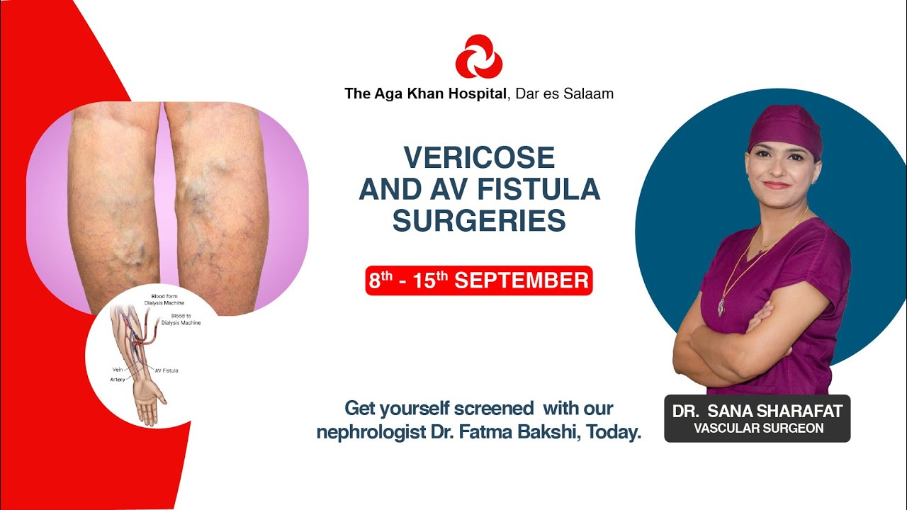 Know more about Varicose Veins procedures from Dr. Sana Sharafat - YouTube