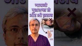 चेस्ट वर्कआउट से गाइनेकोमास्टिया और भी खराब | gyno made worse by chest exercises.