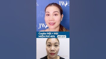 Việt kiều U40 hóa mỹ nữ TRẺ 10 TUỔI sau CẮT MẮT + NÂNG MŨI tại Bệnh viện JW