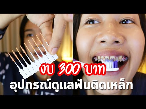 อุปกรณ์ดูแลฟัน สำหรับคนจัดฟันในราคาไม่เกิน 300 บาท | Archii