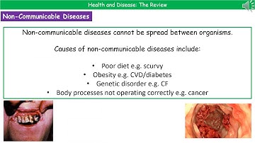 OCR Gateway A B6.3.1 - Health and Disease