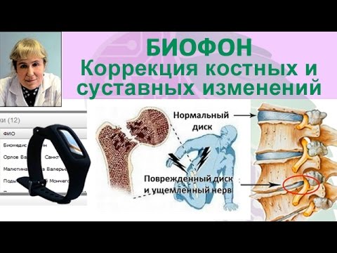 Коррекция костных и суставных изменений. Ч. 1. Приборы БИОМЕДИС | BIOMEDIS Биорезонансная терапия