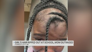 Arkansas mom outraged: Daughter's hair ripped out at school