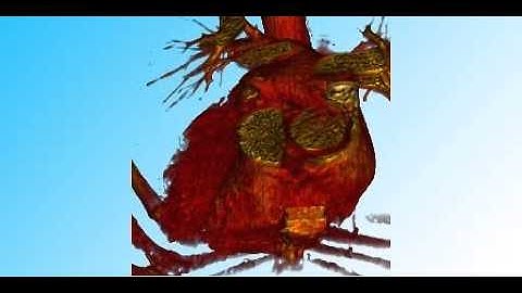 Flexible Direct Multi-Volume Rendering in Interactive Scenes (3)