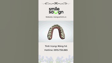 Phác đồ niềng răng hô - Smilesalign Việt Nam