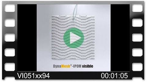 DynaMesh®-IPOM visible - Animation: 3D Reconstruction