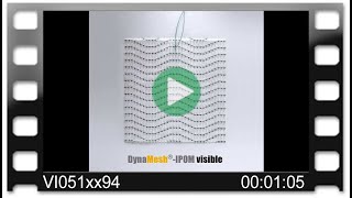 DynaMesh®-IPOM visible - Animation: 3D Reconstruction