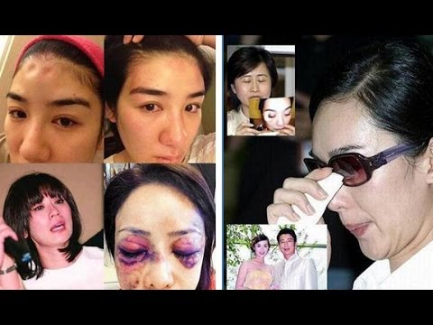娛樂圈中的這些女星都嫁入豪門遭到家暴，其中有一位至今忍辱沒離婚！