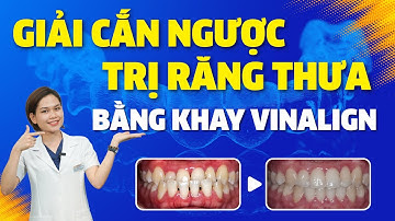 Niềng Răng Giải Cắn Ngược - Trị Răng Thưa Chỉ Sau 1 Năm Bằng Khay Niềng Răng Trong Suốt Vinalign
