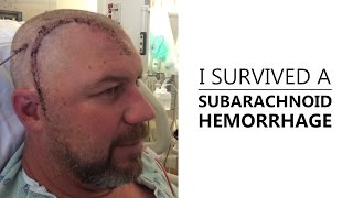 I Survived A Subarachnoid Hemorrhage