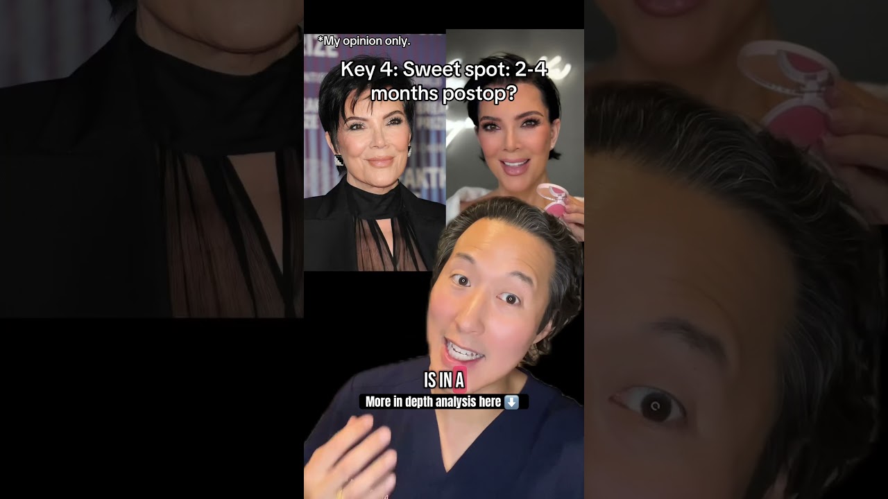 How Does Kris Jenner Look So Incredibly Young? Plastic Surgeon Breakdown!