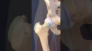 Hip Bursa & Impingement Explained