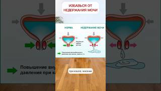 Простое Упражнение От Недержания Мочи В Любом Возрасте