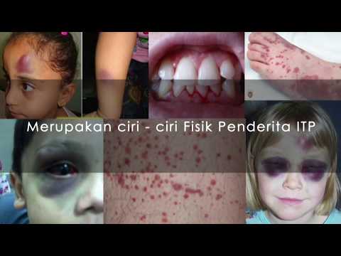 Video: Adakah petechiae dan purpura adalah perkara yang sama?