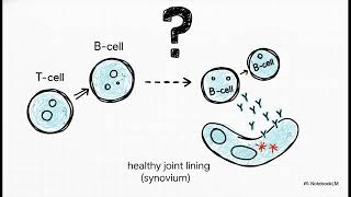 Rheumatoid Arthritis: How to diagnosis and management 