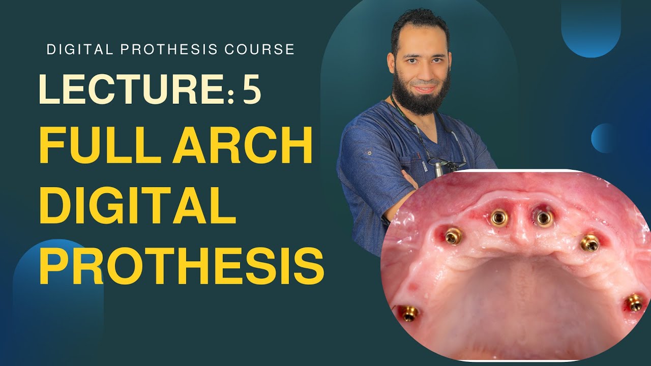 Lecture 5: Full Arch Digital Prosthesis