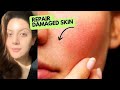 How to repair a broken skin barrier after using actives &amp; retinol | How to protect skin barrier