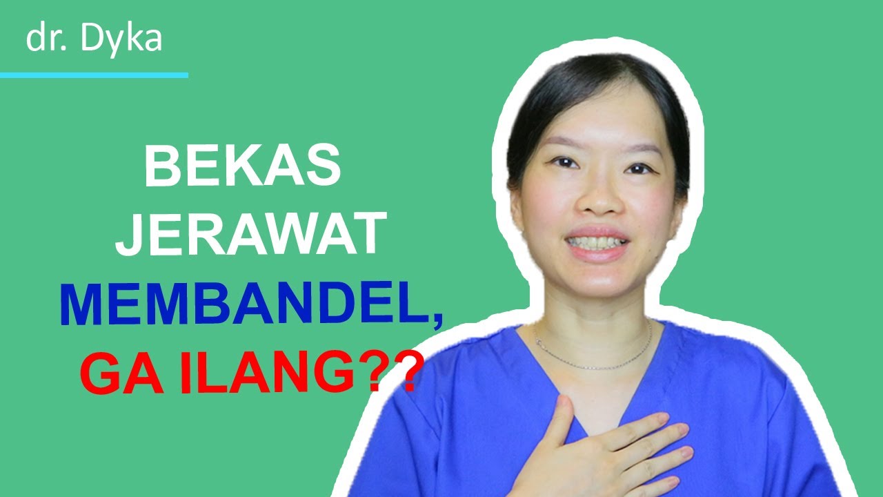 Bekas jerawat di punggung? Kok bisa? | dr. Dyka 