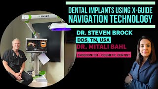 Dental Implant Surgery with 3D-Dynamic Navigation Technology using X-Guide Navigation System