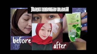 [WAJIB PUNYA] SARIAYU KREM MASKER JERAWAT AMPUH!!!