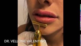 Valentino Vellone-11