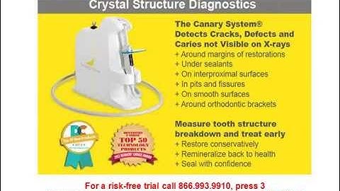 2014 04 02 19 00 Caries Detection -- Earlier Is Better for your patients, and your practice