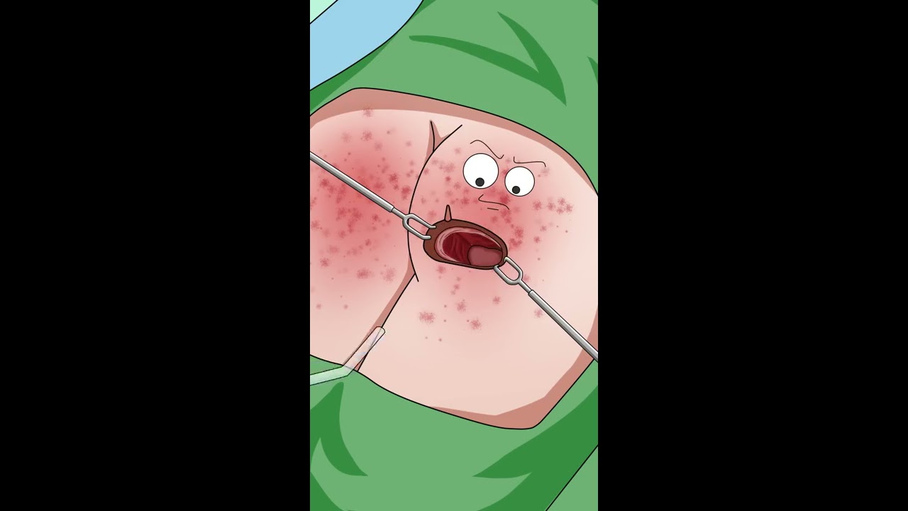 老爷子比达神还能忍Bedsore debridement