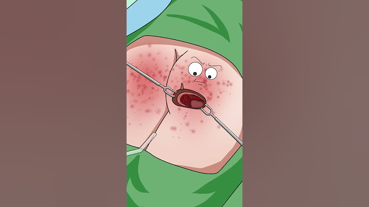 老爷子比达神还能忍Bedsore debridement