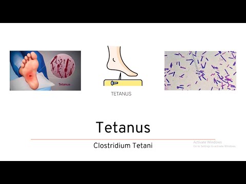 Tetanus (Clostridium Tetani)