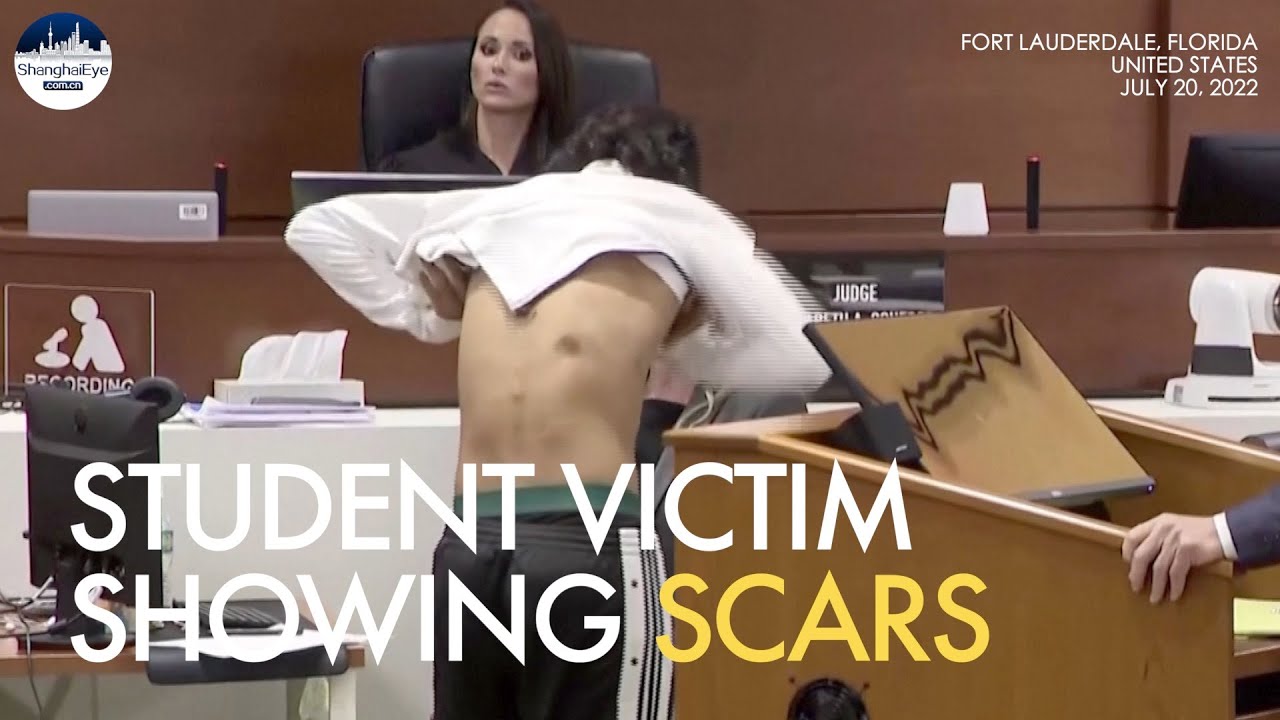 Student victim, shot five times, shows scars from Parkland school shooter in Florida court