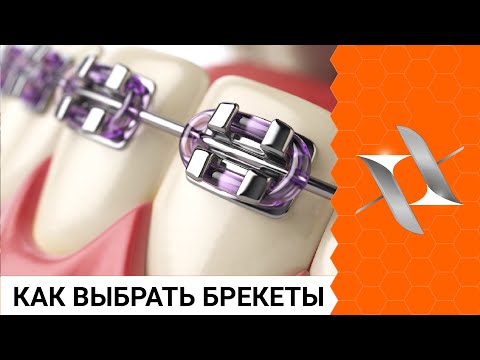 Как выбрать БРЕКЕТЫ и не прогадать? (Осознанный выбор)