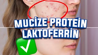 Miracle Protein: LACTOFERRIN (What is it, how is it used, what are its benefits?) DON'T PROBLEM ACNE