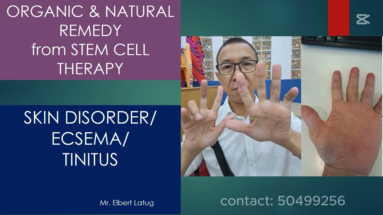 ORGANIC PRODUCT-STC30 TESTIMONIES