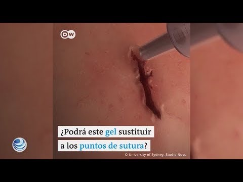 Interesante método para cerrar heridas sin puntos de sutura