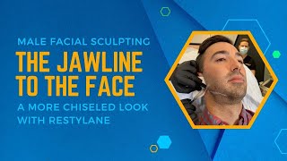 MALE FACIAL SCULPTING THE JAWLINE TO THE FACE A MORE CHISELED LOOK WITH RESTYLANE | DR JASON EMER