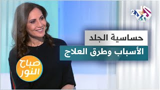 حساسية الجلد.. الأسباب وطرق العلاج وبعض النصائح المهمة