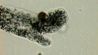 Amoeba in State of Expansion