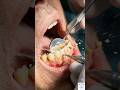 mouth smell fix process #dentalcare #oralcare #dental #dentaltips #sensitivity #viral #smellfresh