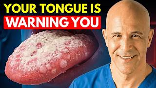 LOOK AT YOUR TONGUE RIGHT NOW! 6 Signs Your Body Is Rotting Inside | DR. MANDELL