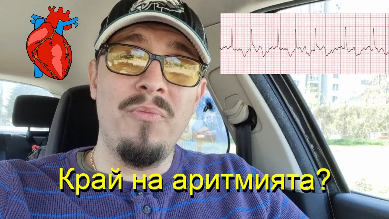 Борбата с ритъмните нарушения | Крио Аблация| Катетърна аблация | Аритмии | Предсърдно мъждене