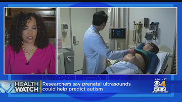 ¿Pueden detectarse signos de autismo en una ecografía prenatal rutinaria?