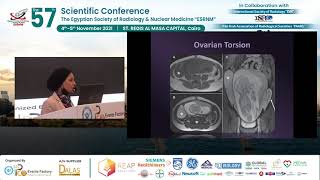Gynecological & Obstetric Emergencies-Imaging Perspective
