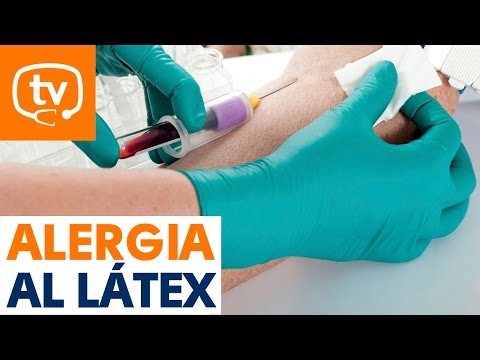 Vídeo: Alergia Al Látex: Síntomas Y Tratamiento