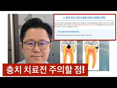 충치 그냥 치료하면 망합니다!
