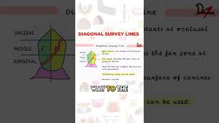 Diagonal Survey Lines