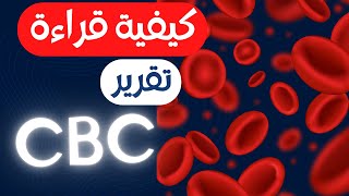 39_ازاي نقرأ ونفهم تقرير cbc وكيفية كتابة كومنت علي كل تقرير !!!