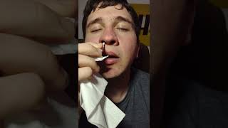 Teasing A Stubborn Nose M