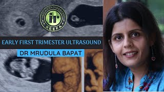 EARLY FIRST TRIMESTER ULTRASOUND | DR MRUDULA BAPAT |