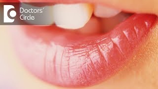 Which vitamins or minerals can help manage lip Angioedema?-Ms. Sushma Jaiswal