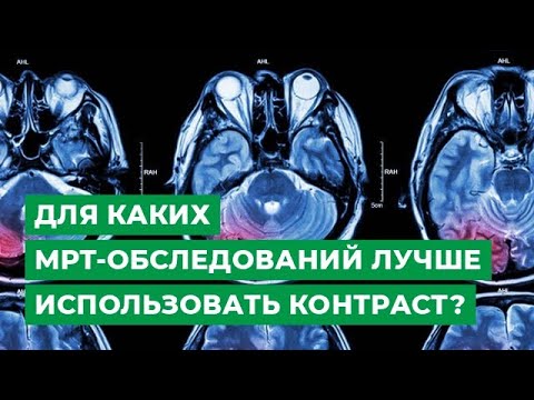 Для каких МРТ-обследований лучше использовать контраст?